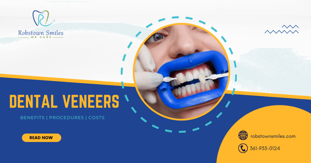 Dental Veneers: Benefits, Procedures, And Costs - Robstown Smiles