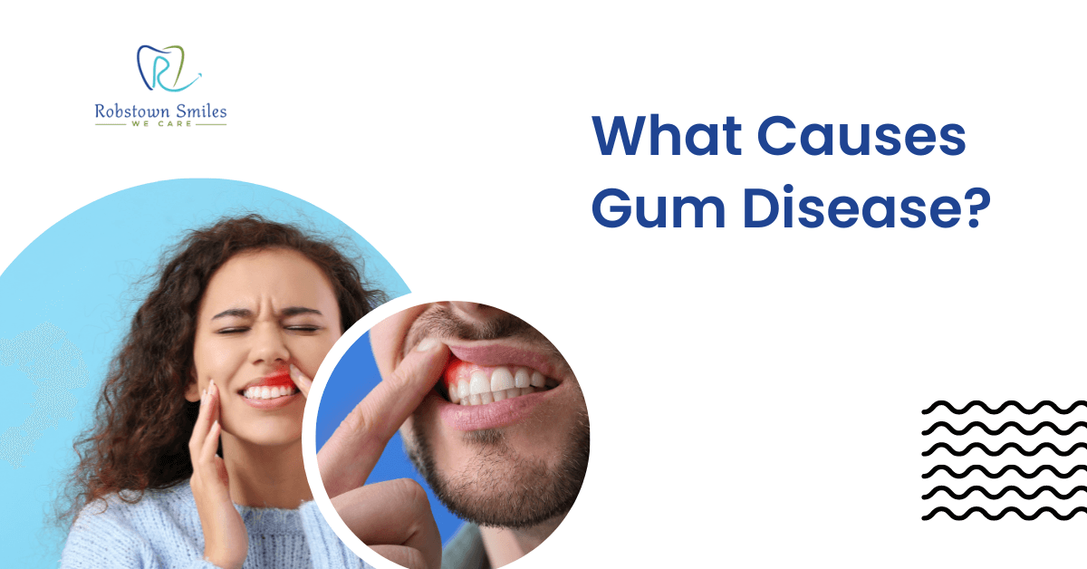 What Causes Gum Disease and How to Prevent It | Robstown Smiles